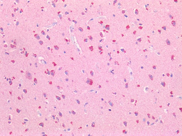 Figure 5. Immunostaining of human formalin fixed, paraffin embedded tissue sections of cerebral cortex with 0566P (diluted 1:400), showing the specific pattern of NCAM/CD56 in the neural  cell types. As expected, no reactivity is seen in the connective tissue